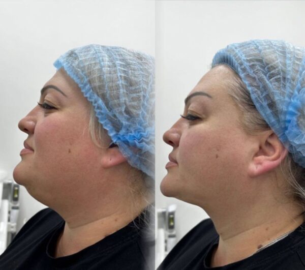 WhatsApp Image 2024-05-10 at 16.09.11