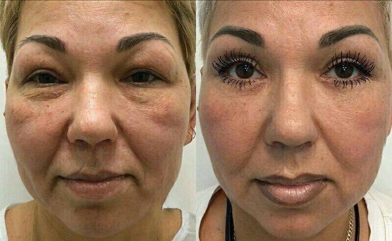 photo_2024-10-18_16-19-17